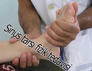 sinüs tarsi sendromu fizik tedavisi