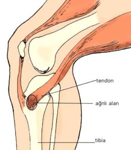 pes anserin bursiti