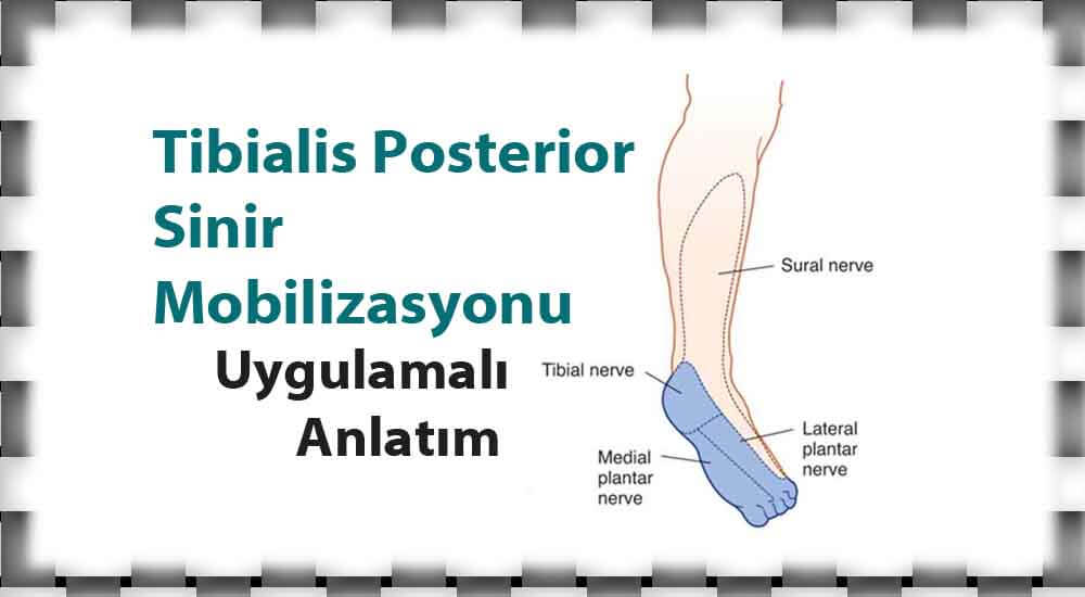 Tibialis Posterior Sinir Mobilizasyonu