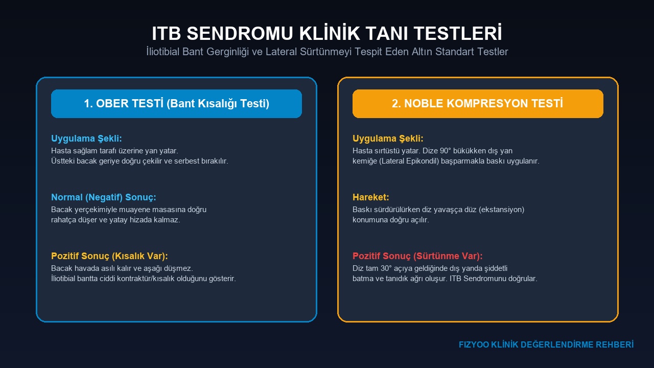 ITB Sendromu Klinik Tanı Testleri Ober ve Noble Şeması